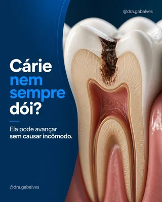 Post de odontologia sobre cárie sem dor